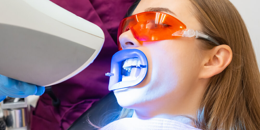 Teeth Whitening Toronto